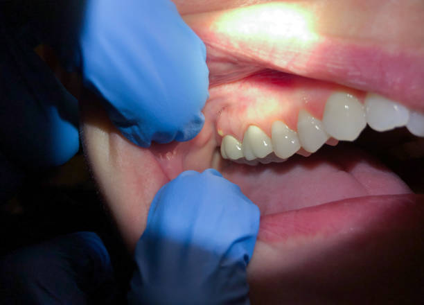 Best Cosmetic Emergency Dentistry in Hendron, KY